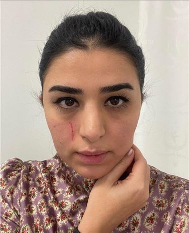 Mersin'de kadın doktora saldırı: 2 gözaltı 